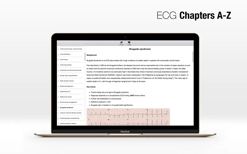ECG A-Z Screenshots