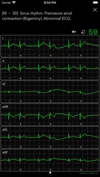ECG Books Pro Ekran Görüntüleri