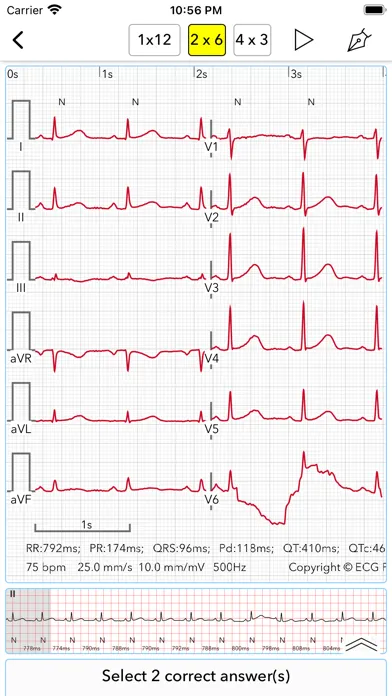 صور ECG Test Pro for Doctors