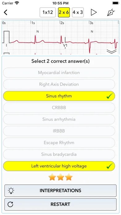 صور ECG Test Pro for Doctors