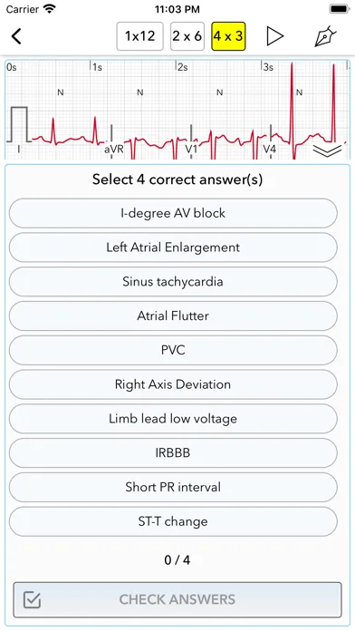صور ECG Test Pro for Doctors
