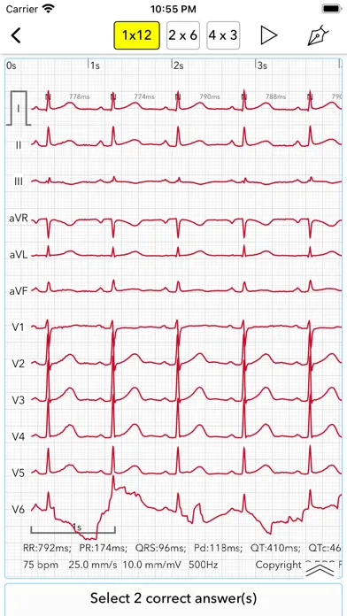صور ECG Test Pro for Doctors