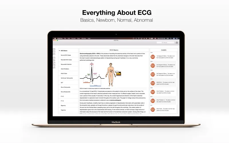 Captures d'écran de ECG PRO - for EMT