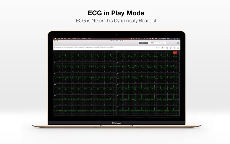 Captures d'écran de ECG PRO - for EMT