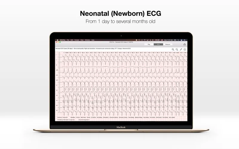 Captures d'écran de ECG PRO - for EMT