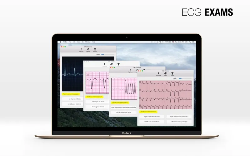 Captures d'écran de ECG PRO - for EMT
