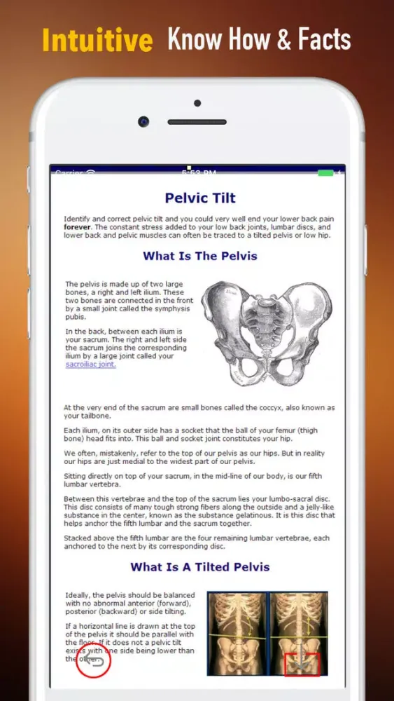 How to Fix Tilted Pelvis-Recovery Guide and Tips سکرین شاٹس
