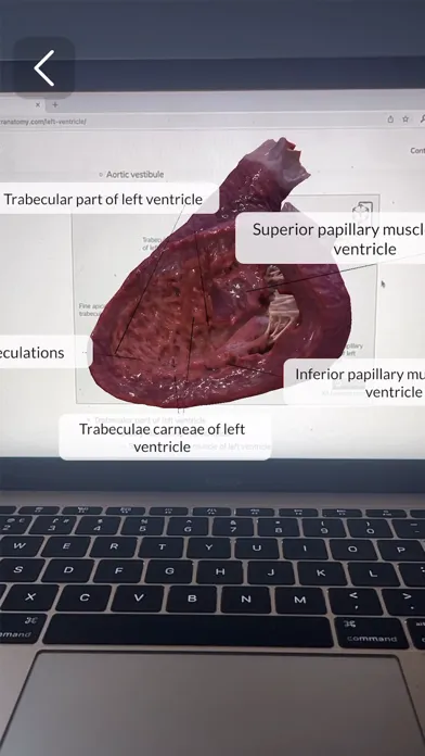 Captures d'écran de XR Anatomy