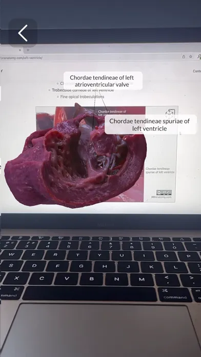 Captures d'écran de XR Anatomy