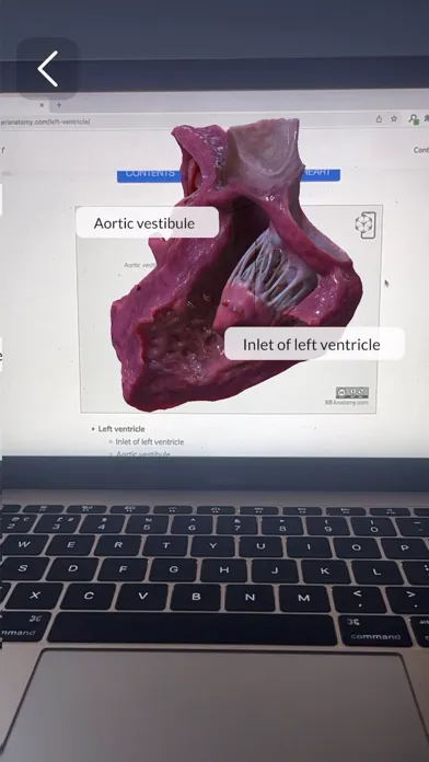 Captures d'écran de XR Anatomy