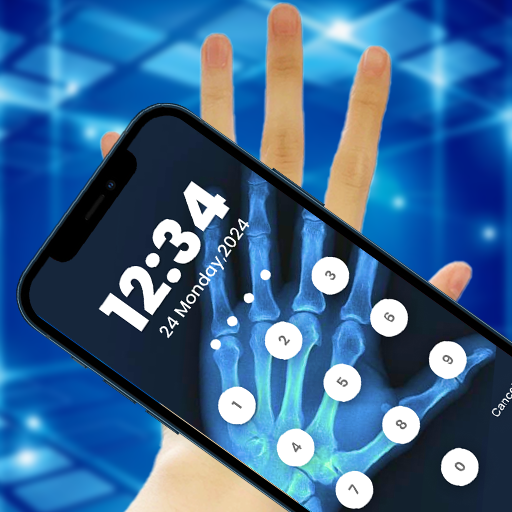 X-Ray Filter Pin Screen Lock