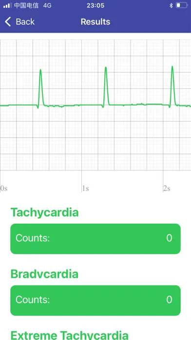 Скриншоты iECG