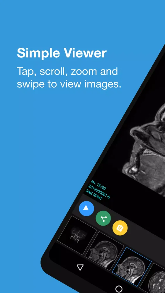Capturas de pantalla de Qscan Referrer Results