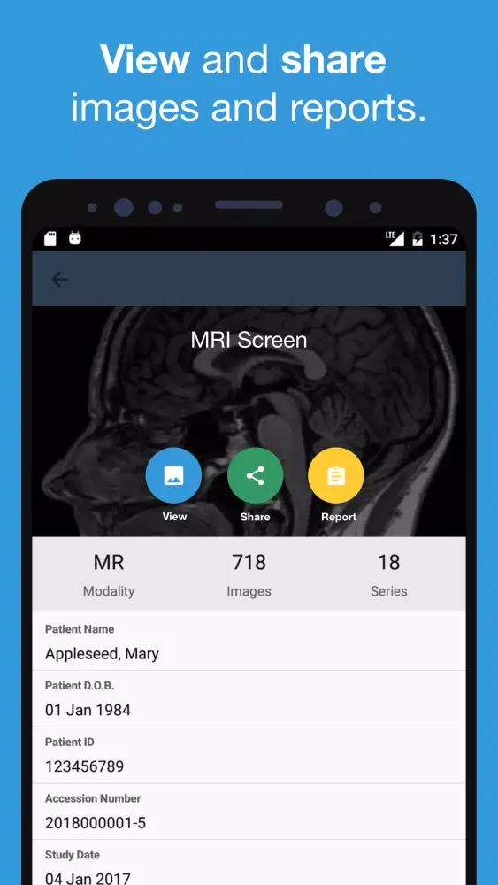 Capturas de pantalla de Qscan Referrer Results