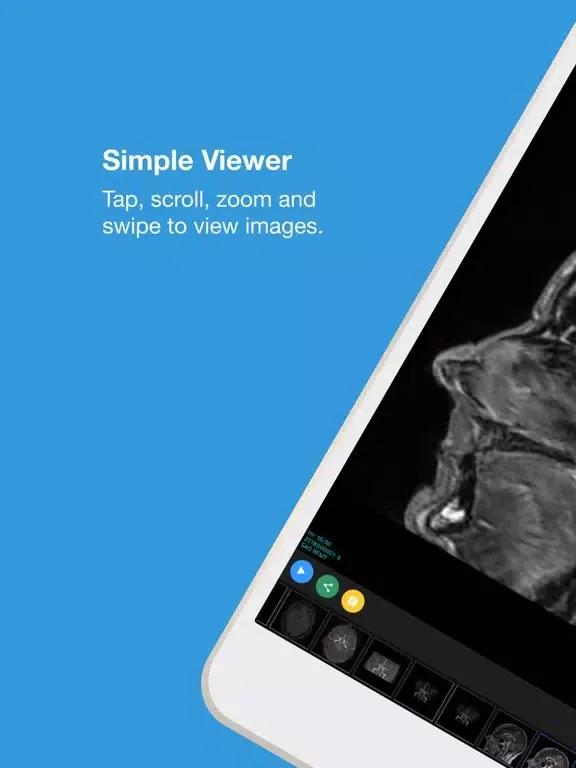 SingMed Diagnostix Viewer iPad  Ekran Görüntüleri