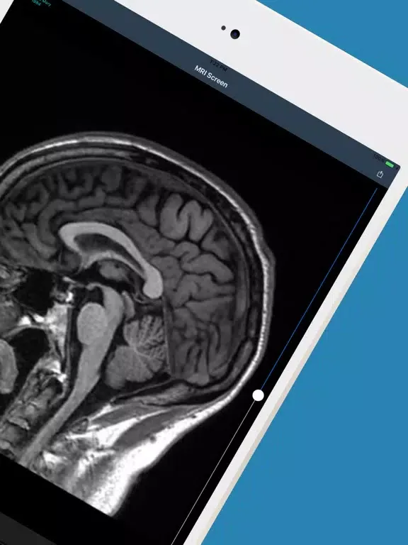 SingMed Diagnostix Viewer iPad  Ekran Görüntüleri