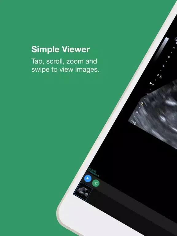 Tangkapan layar My Xrays iPad 