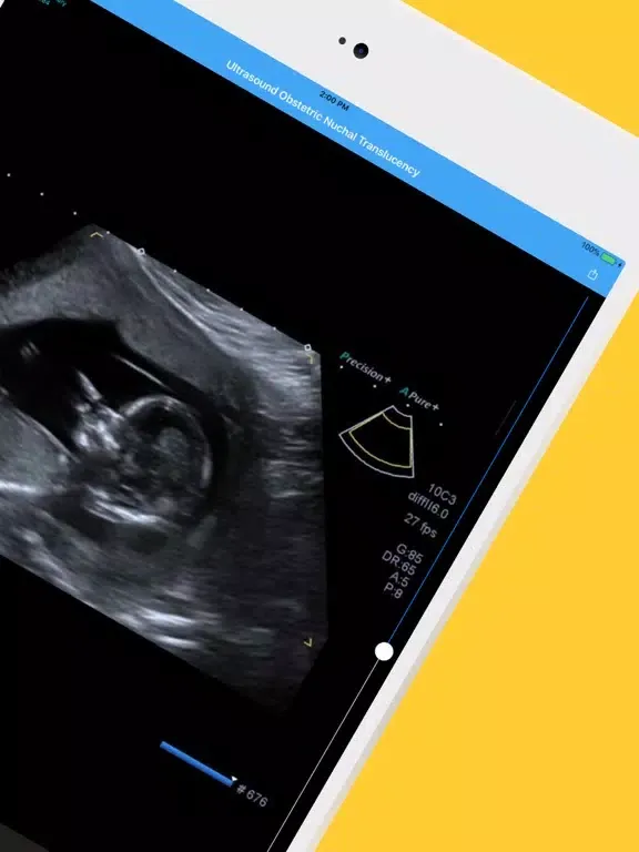Tangkapan layar My Xrays iPad 