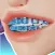 Braces Rush