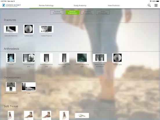 Foot & Ankle - Zimmer Biomet iPad  Screenshots