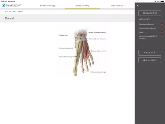 Foot & Ankle - Zimmer Biomet iPad  Screenshots