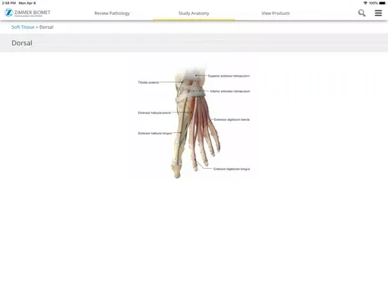 Foot & Ankle - Zimmer Biomet iPad  Screenshots