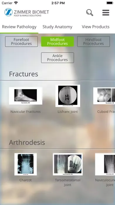 Foot & Ankle - Zimmer Biomet Screenshots