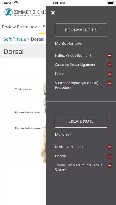 Foot & Ankle - Zimmer Biomet Screenshots