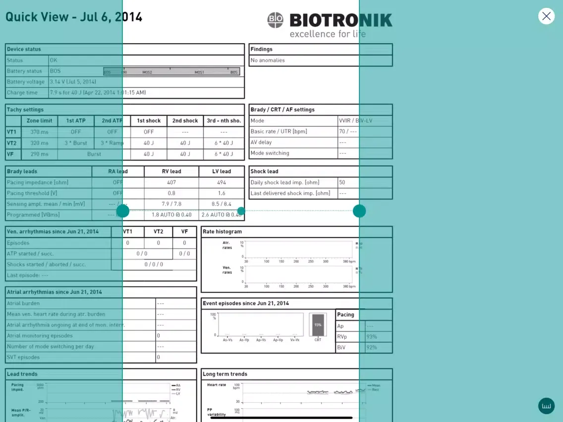 BIOTRONIK Device Expert LITE iPad  स्क्रीनशॉट
