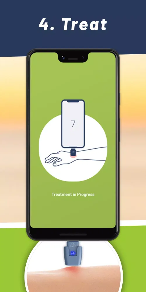 heat it® - Insect bite healer應用截圖