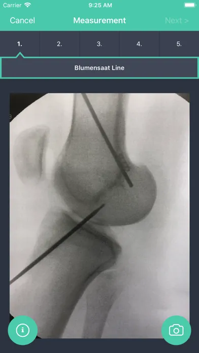 ACL-X Ekran Görüntüleri