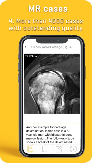 Capturas de tela do MRI-ESSENTIALS: MSK imaging