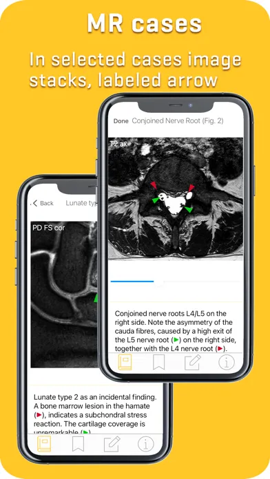 Capturas de tela do MRI-ESSENTIALS: MSK imaging