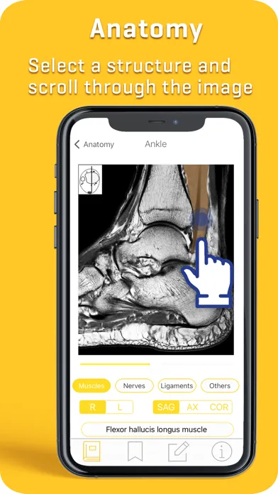 Capturas de tela do MRI-ESSENTIALS: MSK imaging