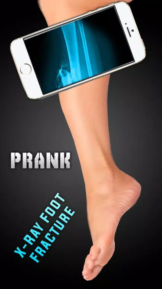 Simulator X-Ray Foot Fracture स्क्रीनशॉट
