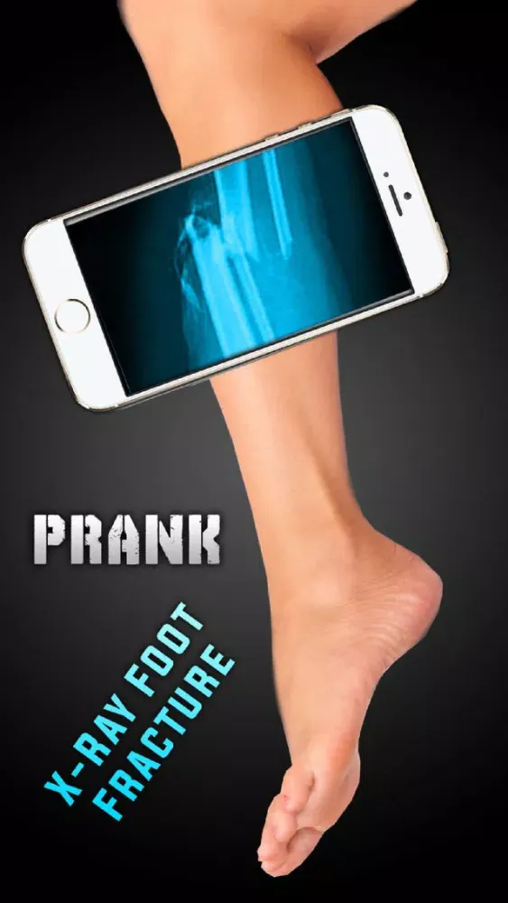 Simulator X-Ray Foot Fracture स्क्रीनशॉट