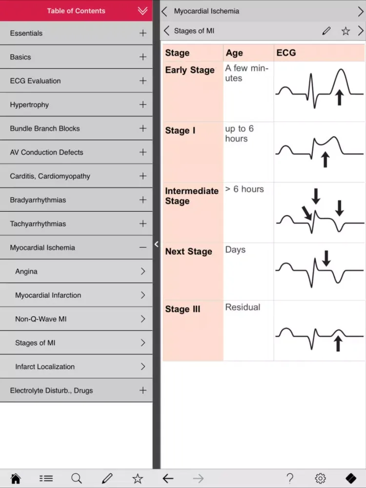 ECG pocketcards iPad 应用截图