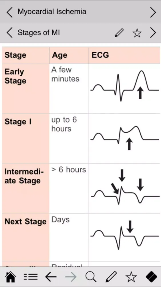 ECG pocketcards应用截图