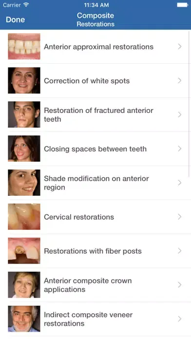 تصاویر Dental Composite