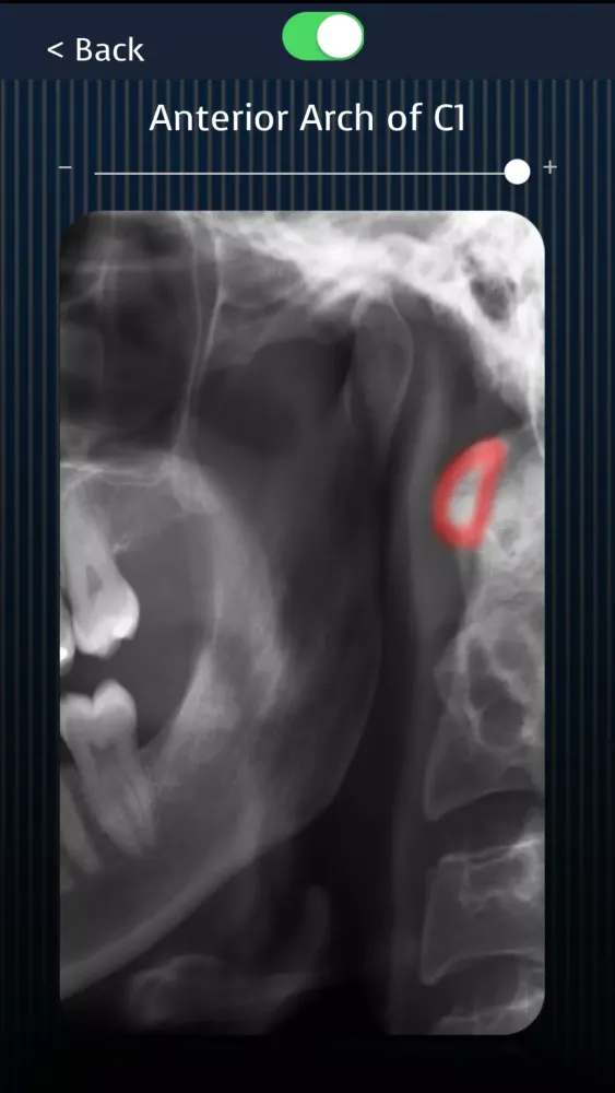 Dental Panoramic Radiology Screenshots