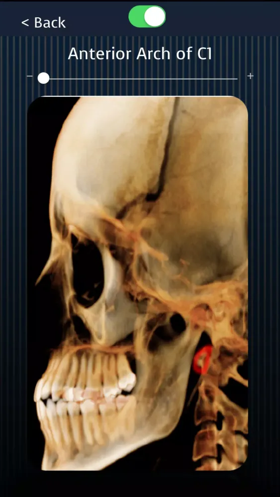Dental Panoramic Radiology Screenshots
