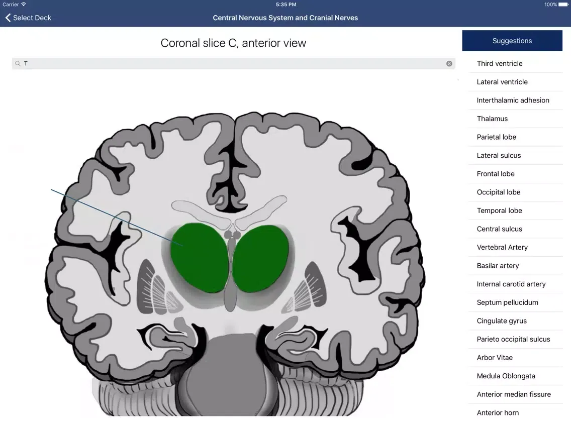 Anatomy SmartCards iPad 應用截圖