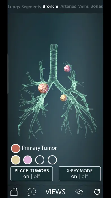 Surgical Anatomy of the Lung 스크린샷