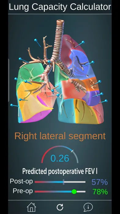 Surgical Anatomy of the Lung 스크린샷