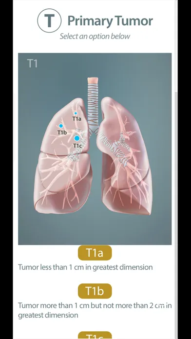 Surgical Anatomy of the Lung 스크린샷