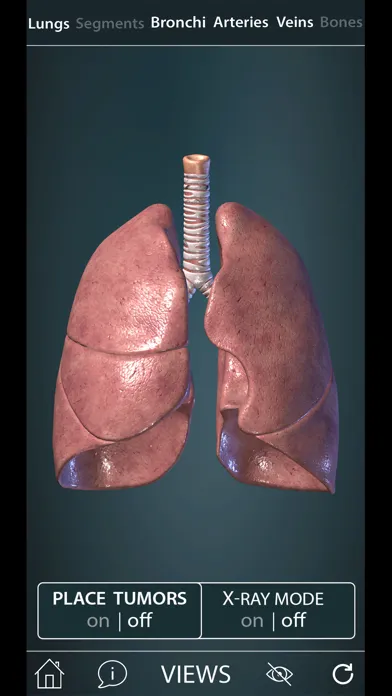 Surgical Anatomy of the Lung 스크린샷