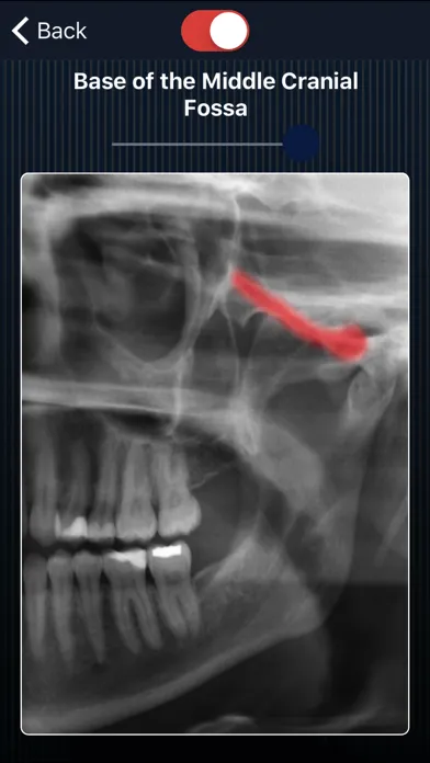 Dental Panoramic Radiology Ekran Görüntüleri