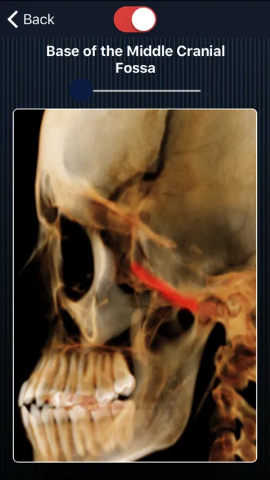 Dental Panoramic Radiology Ekran Görüntüleri