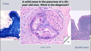 Johns Hopkins Flashcards スクリーンショット
