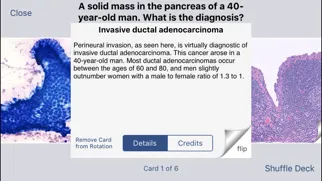 Johns Hopkins Flashcards スクリーンショット